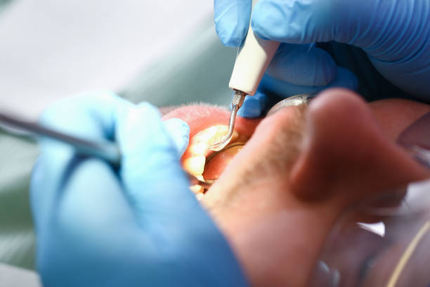 Reliable WY Emergency Dentist Solutions